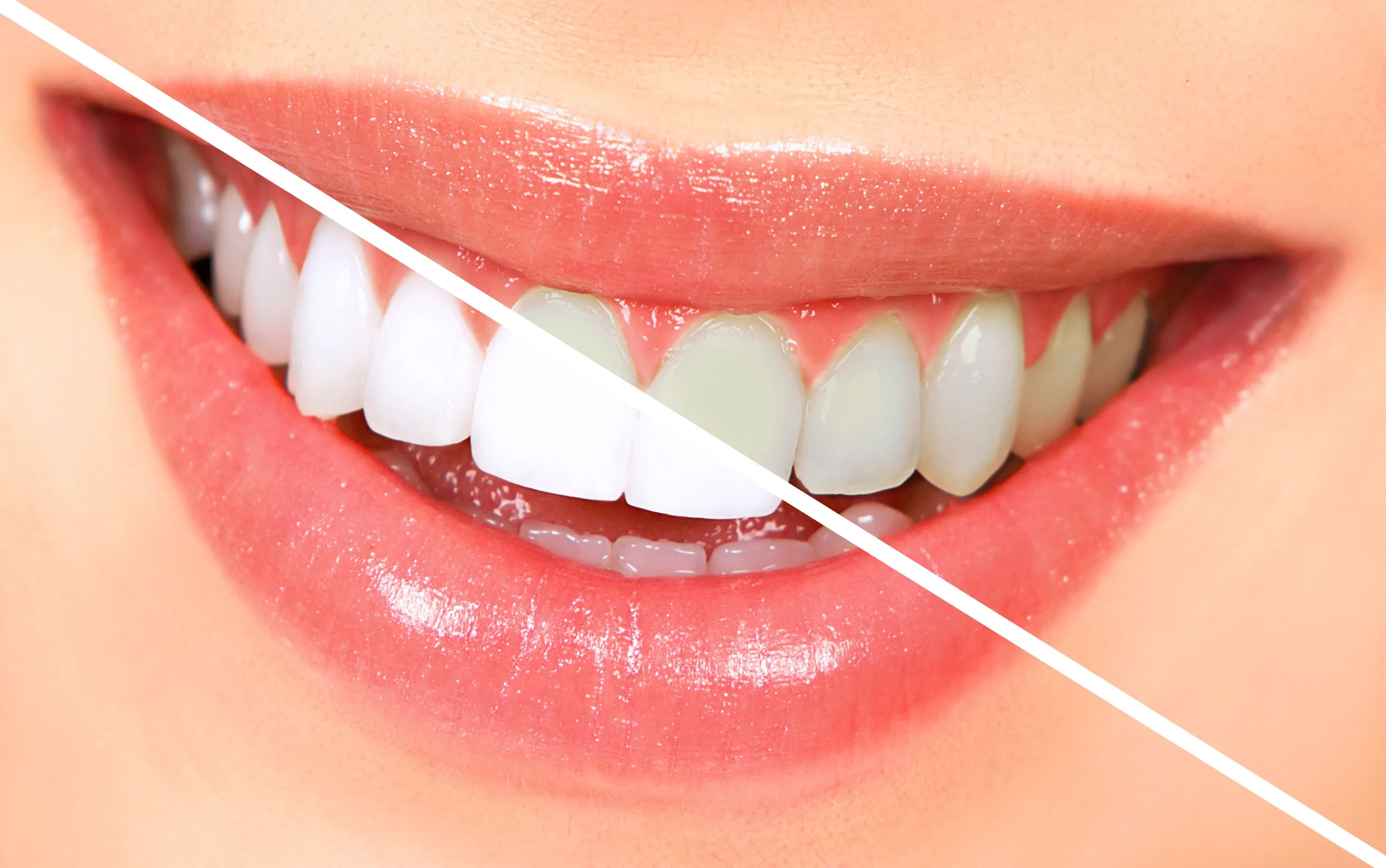 /img/26798-maintaining-bright-smile.webp