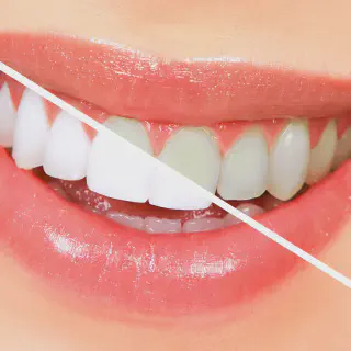 /img/26798-maintaining-bright-smile.webp