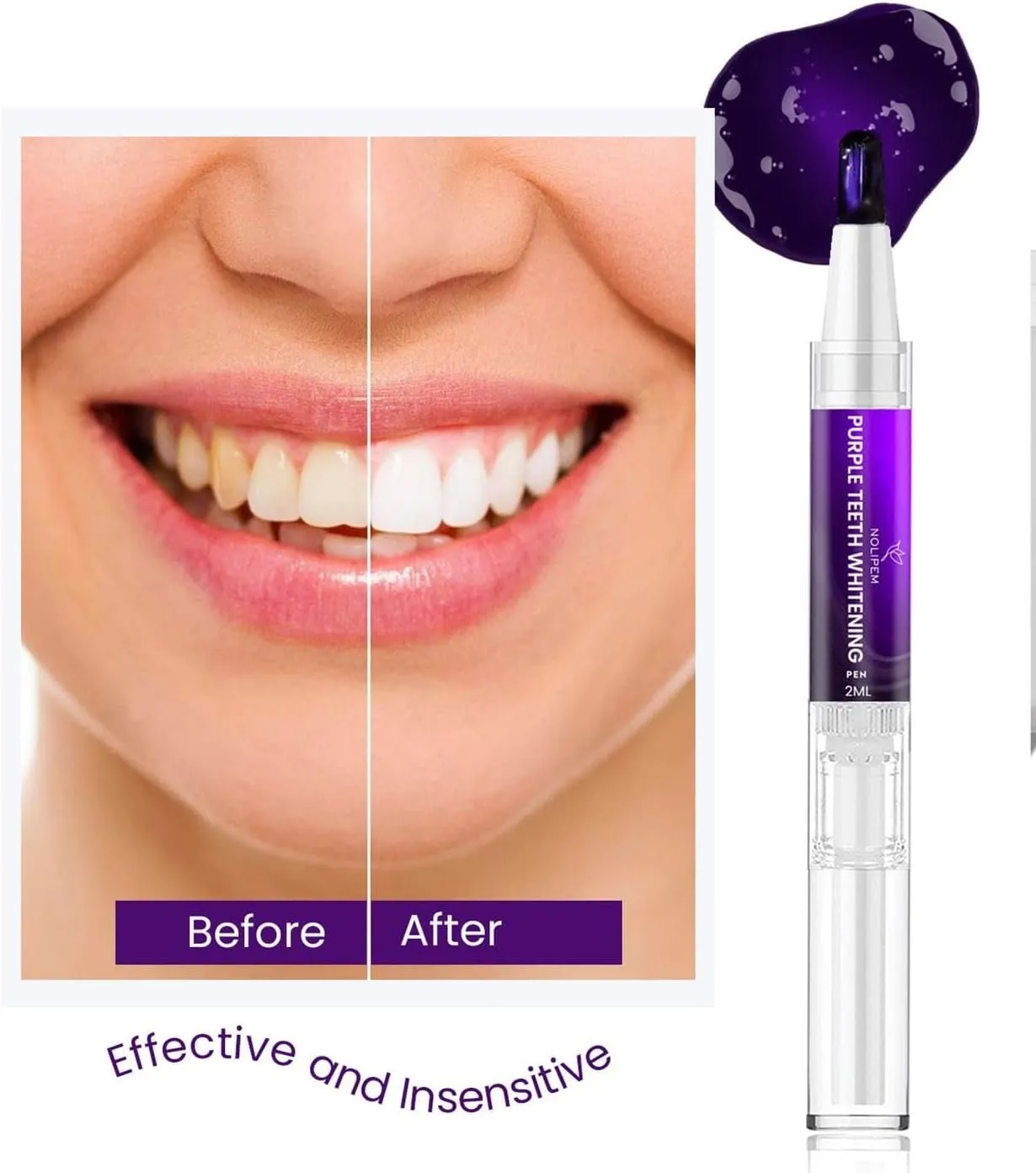 26803 alternatives teeth whitening
