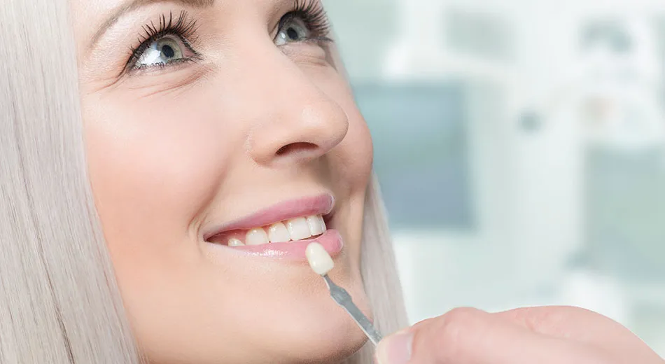 26806 teeth whitening cost