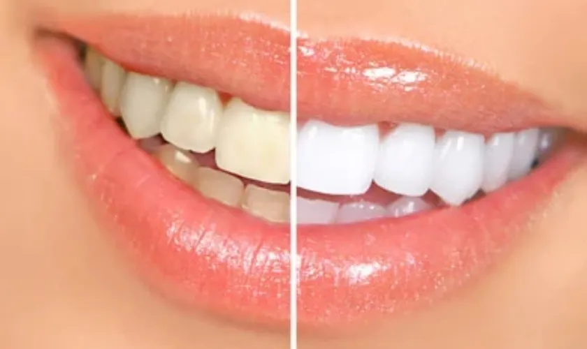 26807 sensitivity teeth