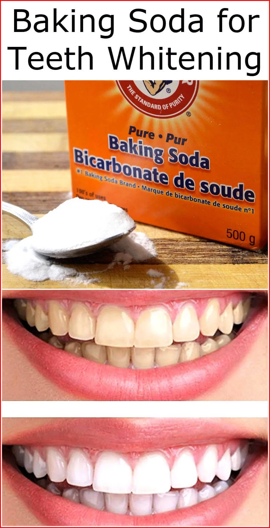 26809 cost effective teeth whitening