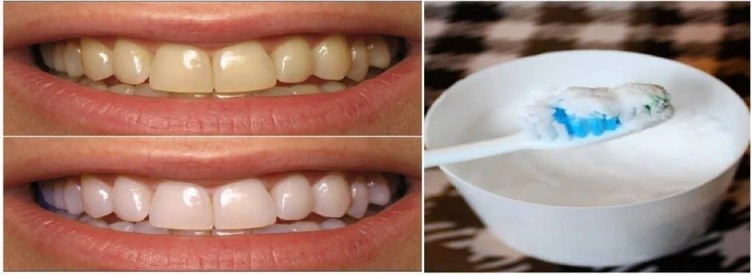 /img/26809-teeth-whitening-alternatives.webp