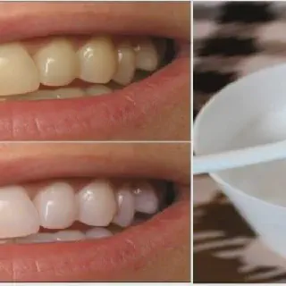 /img/26809-teeth-whitening-alternatives.webp