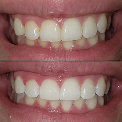 26810 dental checkup