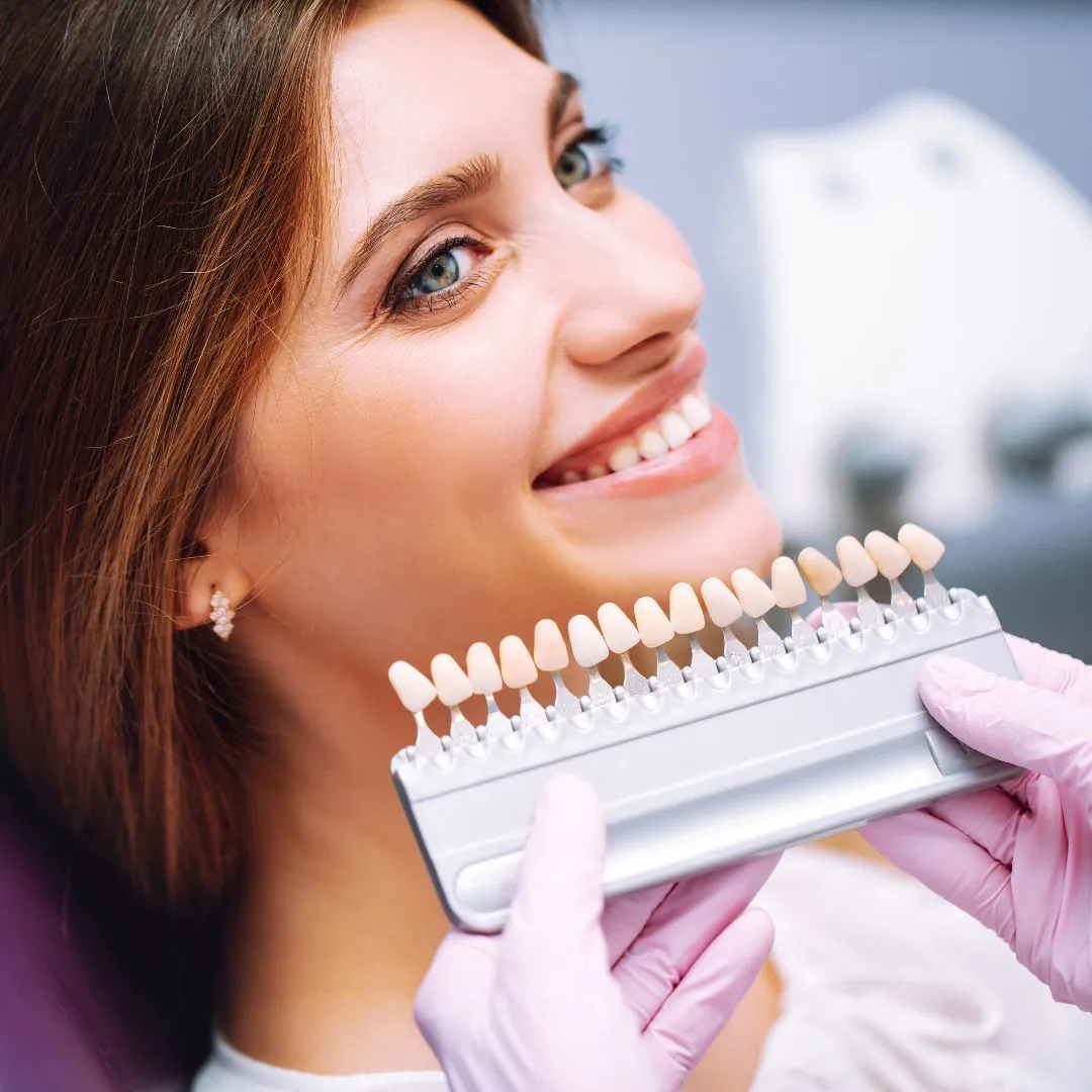 26811 teeth whitening edina mn before after