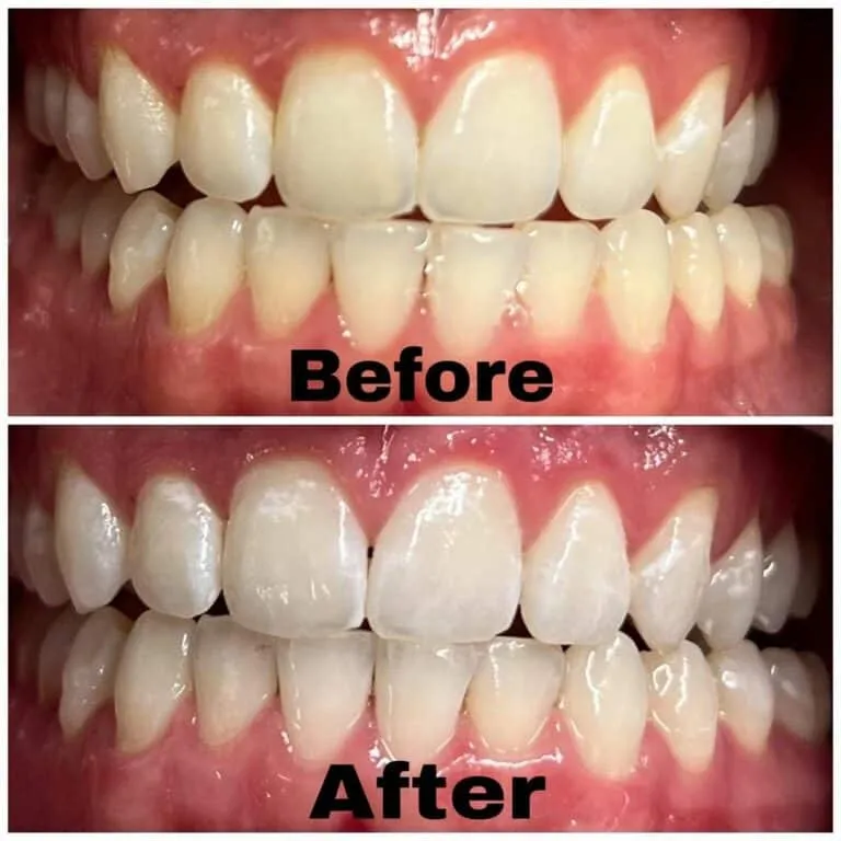 /img/26811-teeth-whitening-edina-mn-healthy-teeth.webp