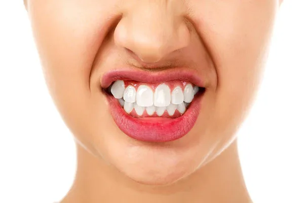 26815 crooked teeth smiling
