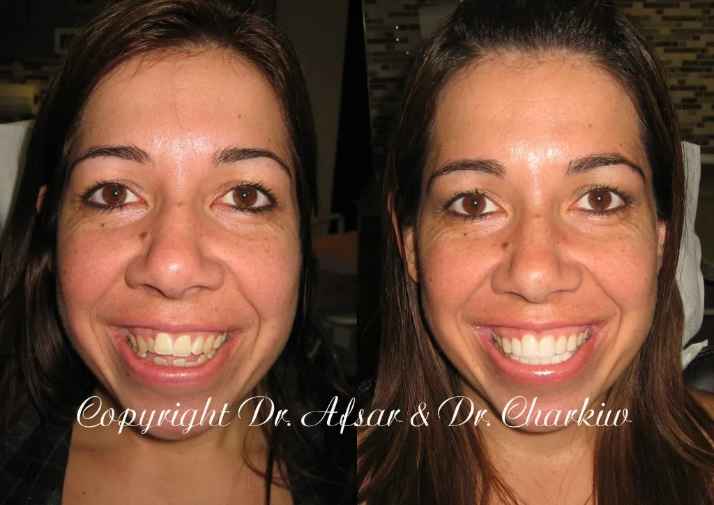 26815 orthodontic treatments