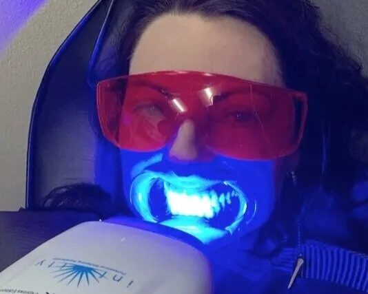 26817 in office teeth whitening