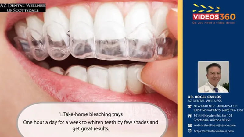 26817 maintaining white smile