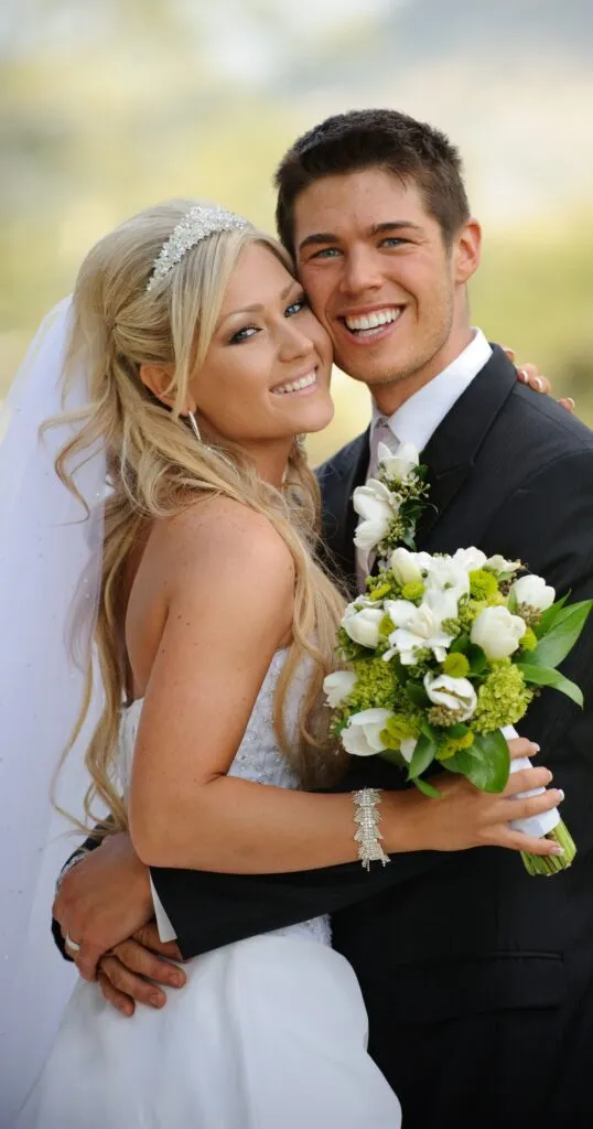 26839 in office teeth whitening