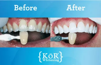 26843 best fort lauderdale dentists