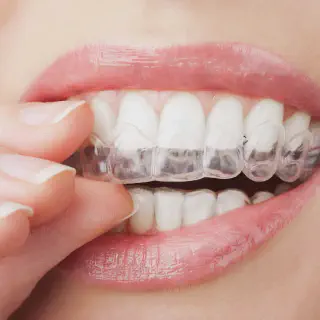 /img/26844-maintaining-teeth-whitening.webp