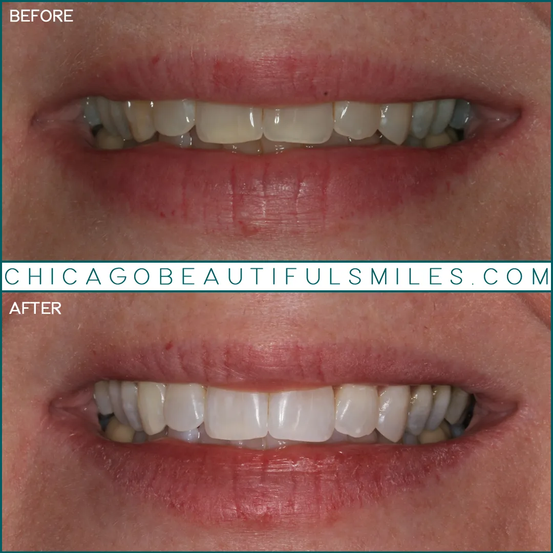 26844 sensitive teeth