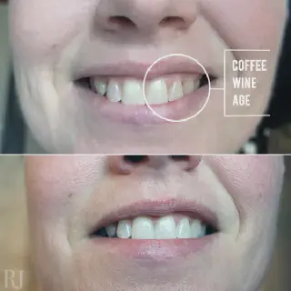 /img/26845-teeth-whitening-oral-health.webp