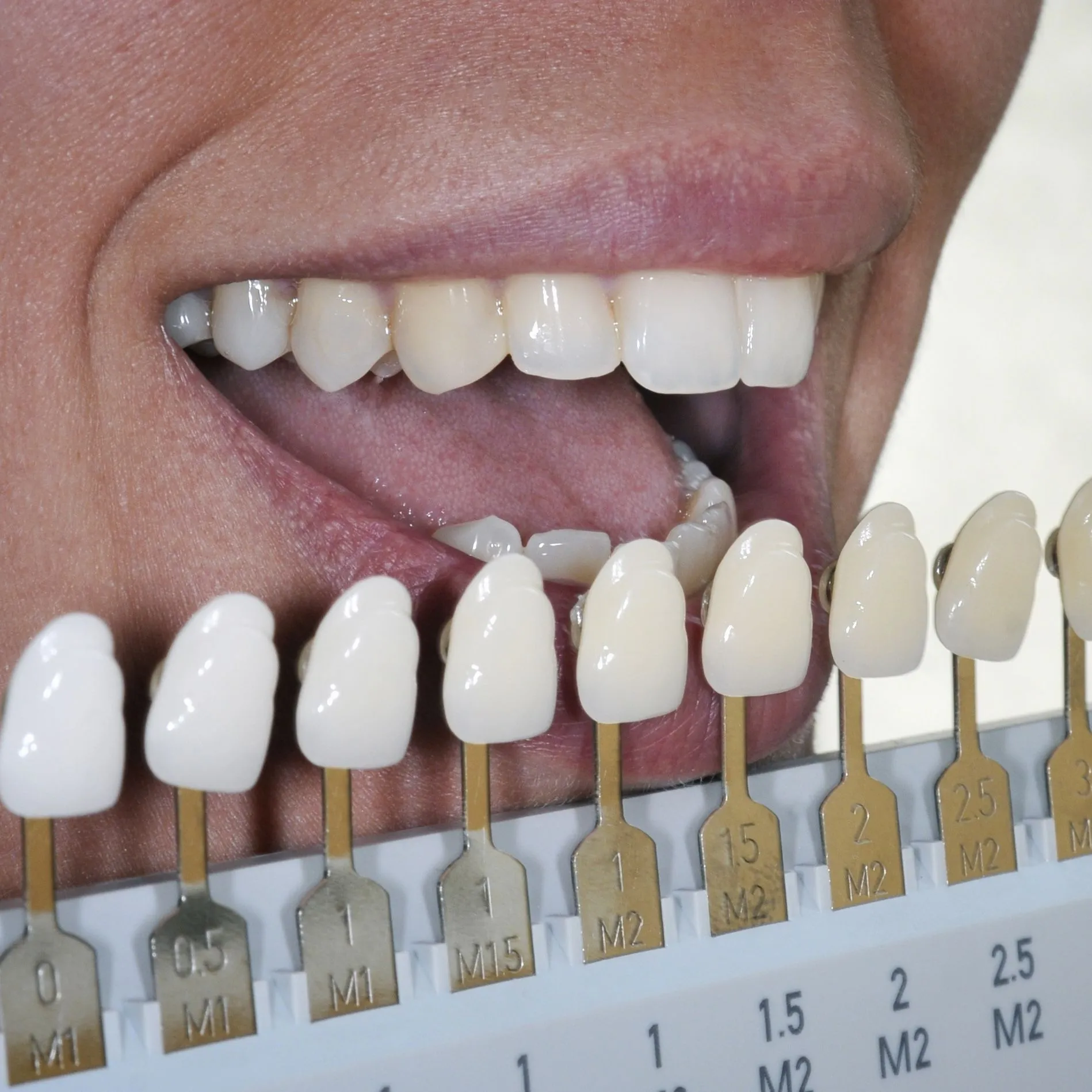 26846 teeth whitening diet