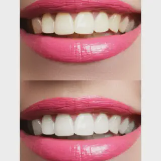 /img/26846-teeth-whitening-maintenance.webp
