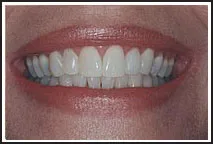 /img/26847-choosing-right-treatment.webp