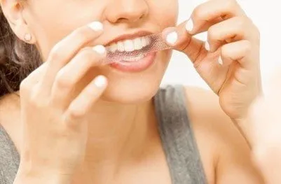26847 professional consultation teeth whitening