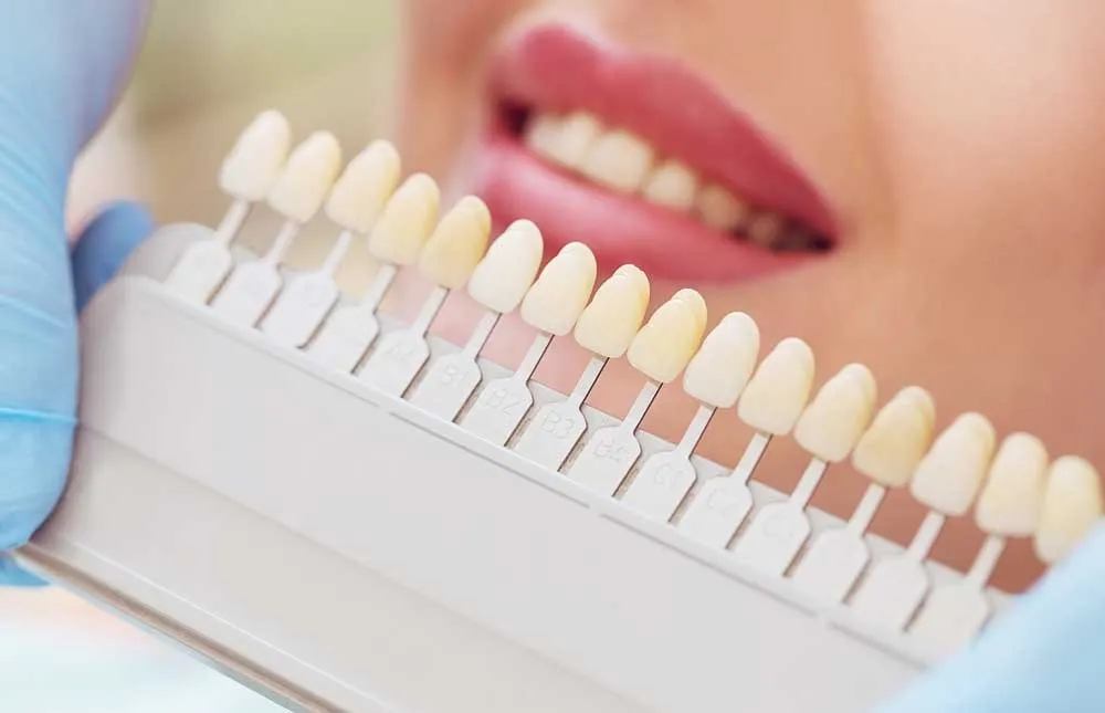 /img/26848-crowns-veneers-replacement.webp