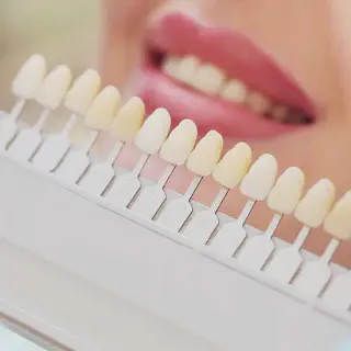 /img/26848-crowns-veneers-replacement.webp