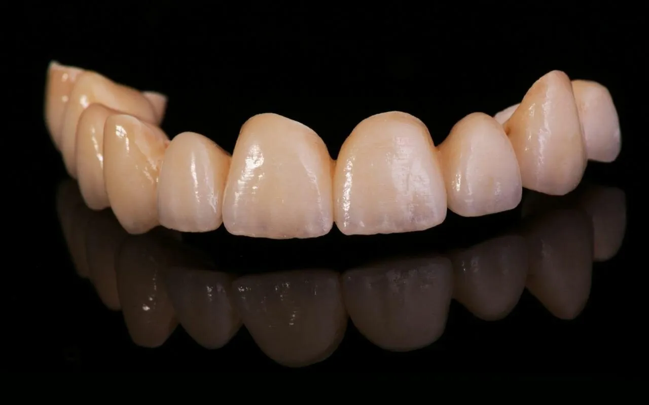 26848 teeth whitening options