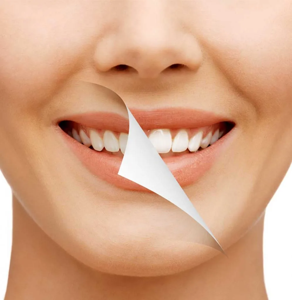 /img/26851-teeth-whitening-before-after.webp