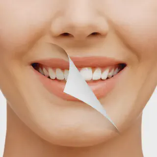 /img/26851-teeth-whitening-before-after.webp