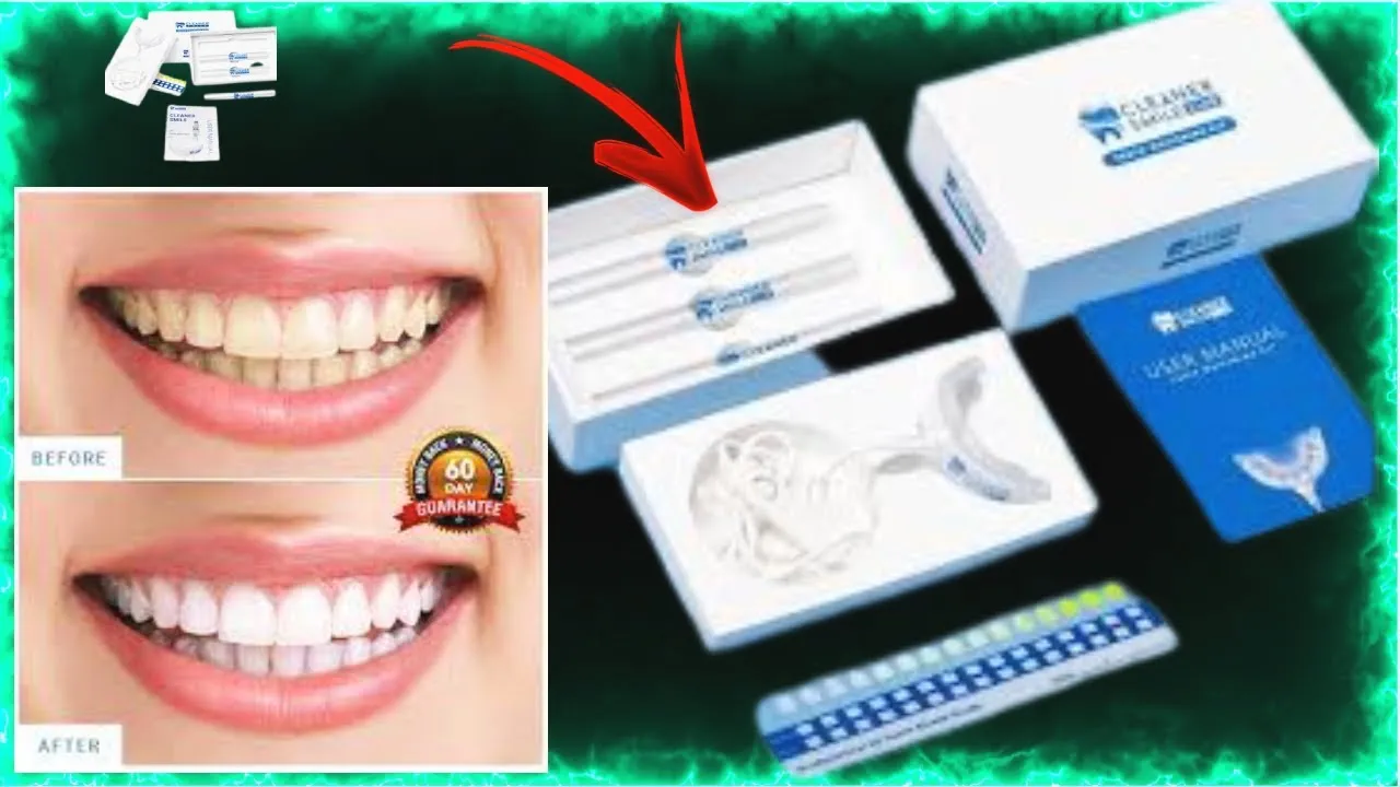 26856 teeth whitening before after