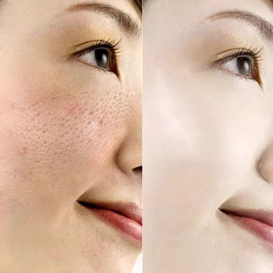 26859 skin whitening image5