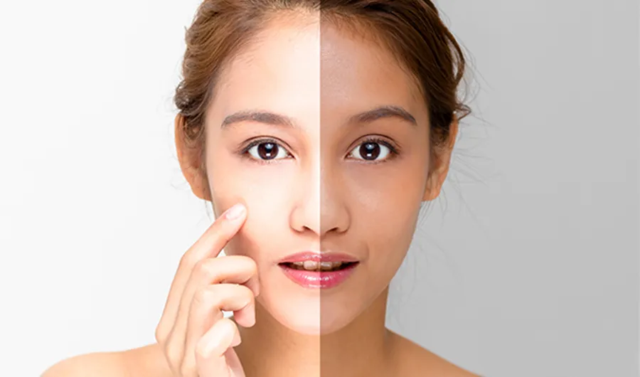 26859 skin whitening image6