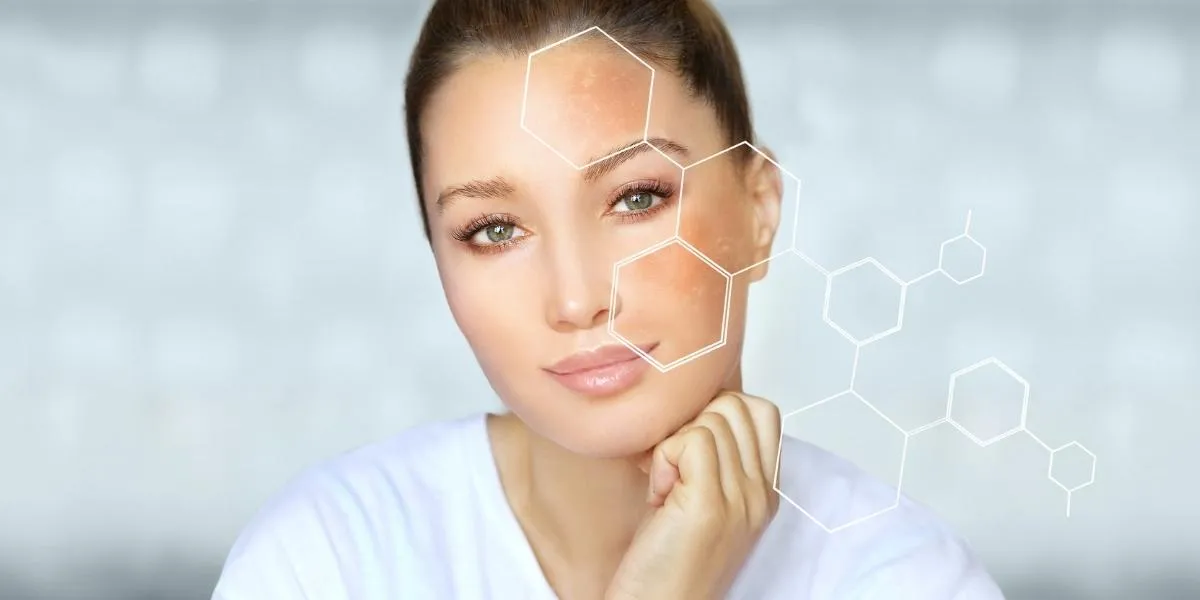/img/26859-skin-whitening-image7.webp