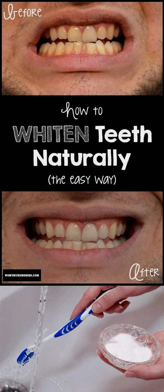 26866 diy teeth whitening results