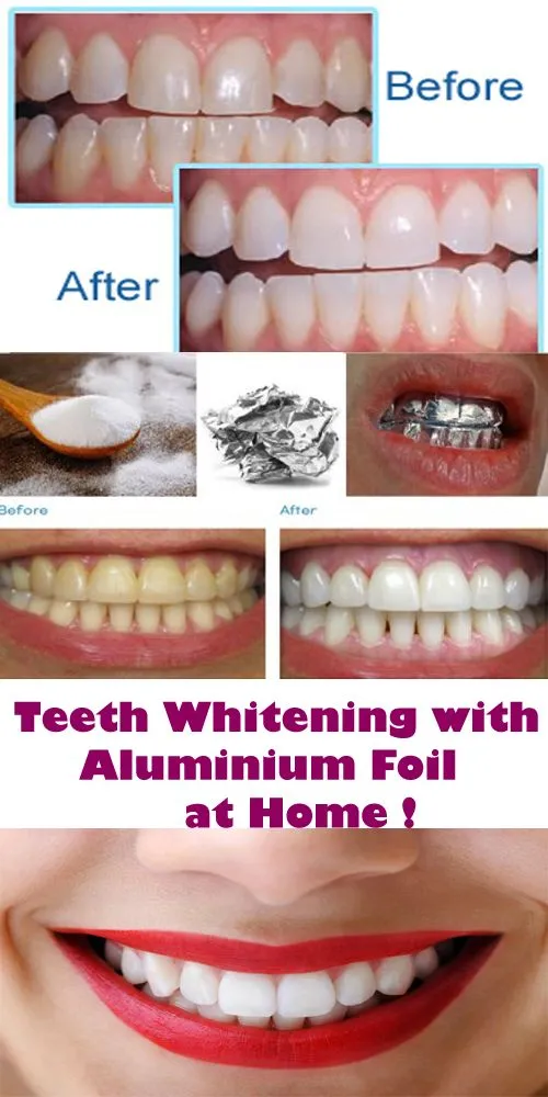 /img/26866-healthy-teeth-smile.webp