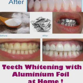 /img/26866-healthy-teeth-smile.webp