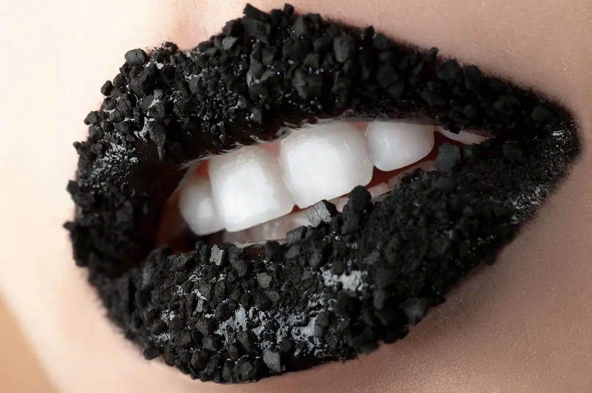 26867 professional teeth whitening