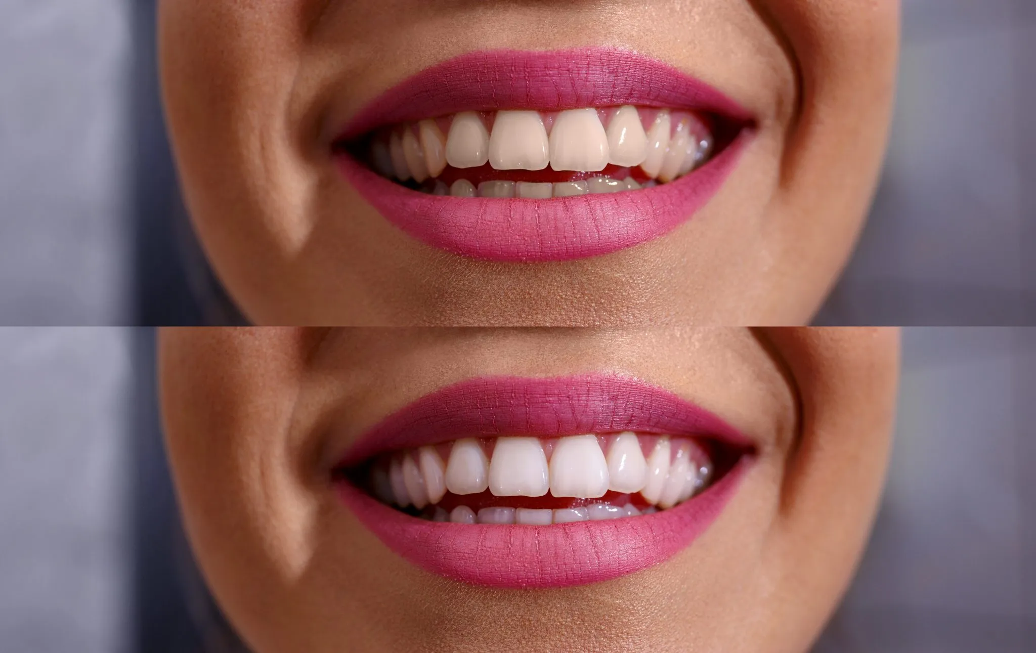 /img/26873-dental-checkups.webp