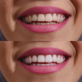 /img/26873-dental-checkups.webp