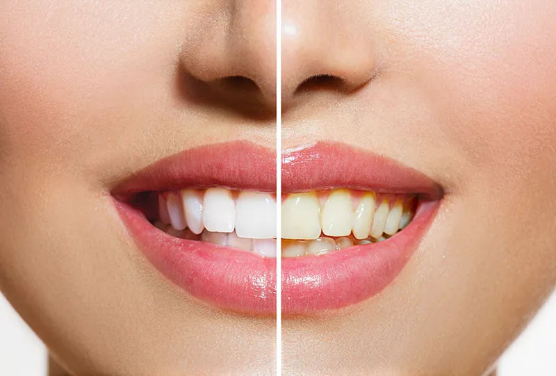 26873 oral hygiene practices