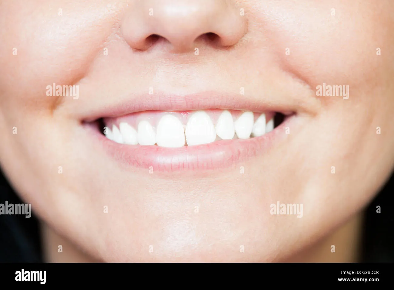 /img/26877-professional-teeth-whitening.webp