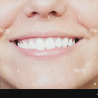 /img/26877-professional-teeth-whitening.webp