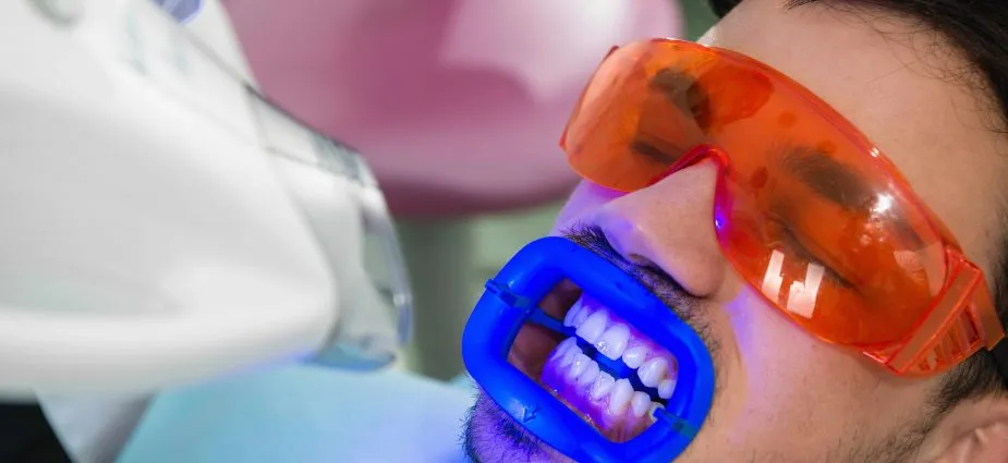 26886 teeth whitening maintenance
