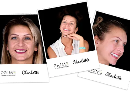 26891 at home teeth whitening