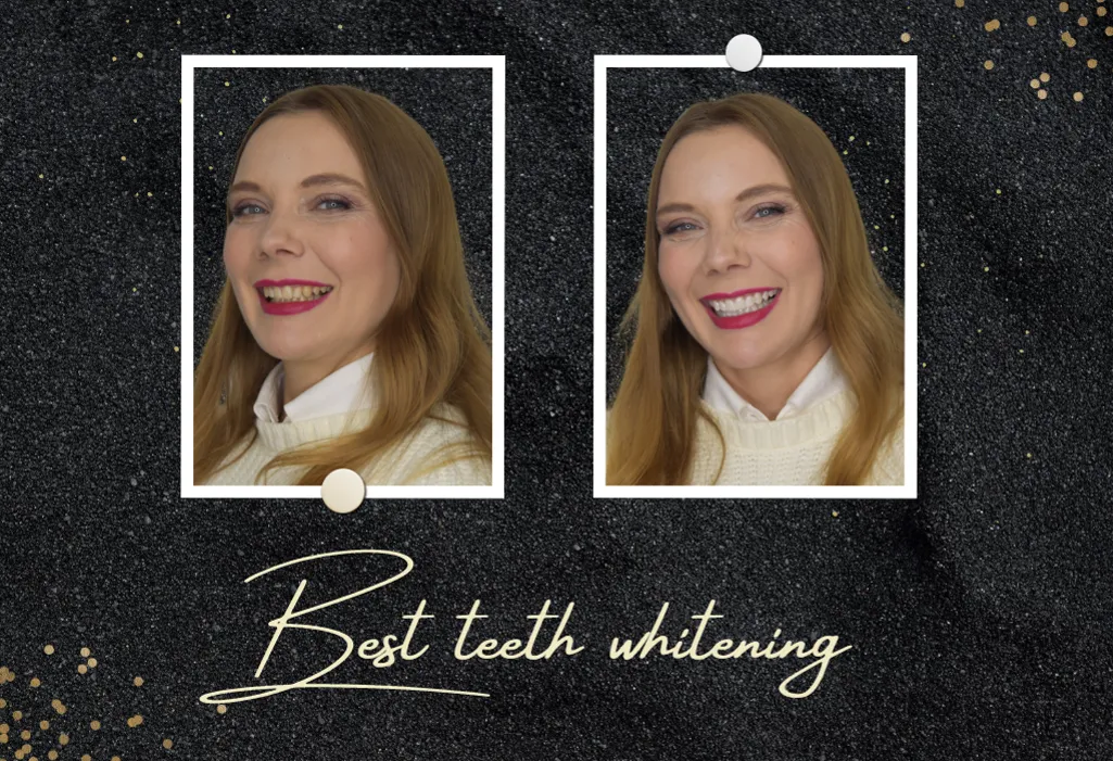 26891 teeth whitening product 3