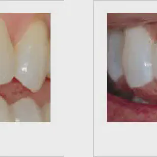 /img/26893-Seminyak-teeth-whitening-review.webp