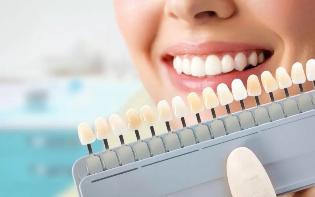 /img/26895-teeth-whitening-jakarta-comparison.webp