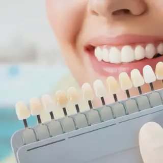 /img/26895-teeth-whitening-jakarta-comparison.webp