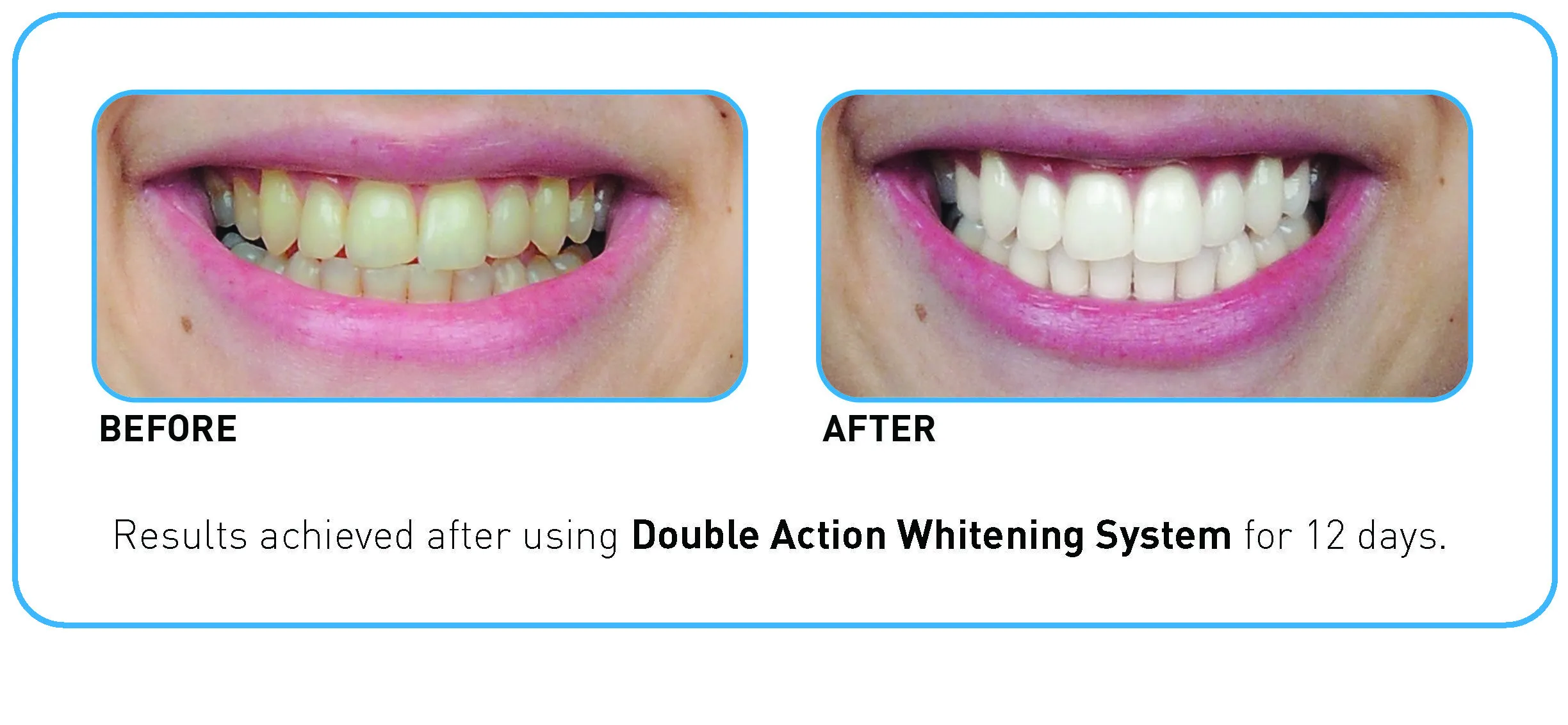 26897 gosmile double action teeth