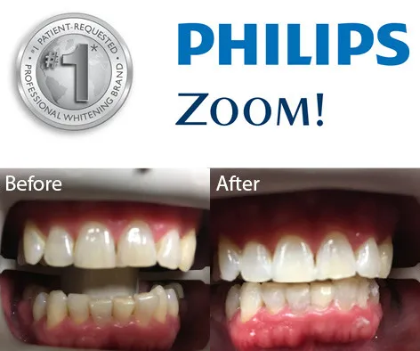 26898 bright smile tips